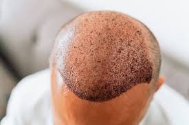 Hair