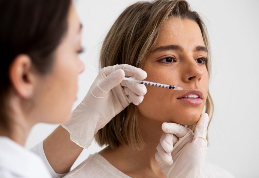 Smile Line Reduction